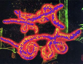  
     
    　8月の10大ホットワードが発表　エボラ出血熱がトップ

       発病者の出たコンゴ（旧ザイール）に流れるエボラ川の名を取って命名されたエボラ出血熱は、フィロウイルス科エボラウイルス属のウイルスを病原体とする急性ウイルス性感染症。出血熱の一つ。世界保健機構（ＷＨＯ）が懸命な調査を行っているものの、自然宿主の特定には至ってはいない。

★「エボラ出血熱」    ★「アイス・バケツ・チャレンジ」    ★「雲南省魯甸県地震」★「房祖名」    ★「江蘇省昆山市の工場爆発事故」    ★「ラーラー」★「拉日鉄道」    ★「独占禁止」★「顔キニ」    ★「日本石猴」