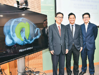 香港大学の研究チーム、海馬体の新機能を発見