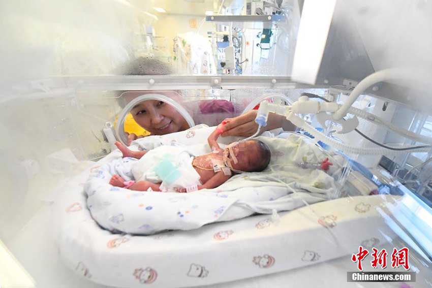 山西省で妊娠24週で誕生した超未熟児の赤ちゃんすくすく育つ