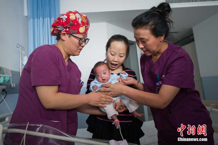 山西省で妊娠24週で誕生した超未熟児の赤ちゃんすくすく育つ