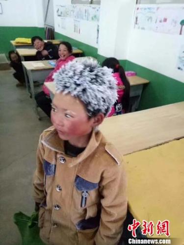 中国、寒波で頭も眉も真っ白になった少年が話題　ボランティアが寄付募る